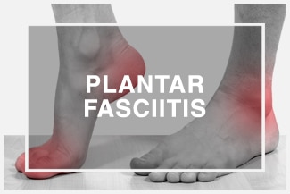 Chiropractic Palm Bay FL Plantar Fasciitis